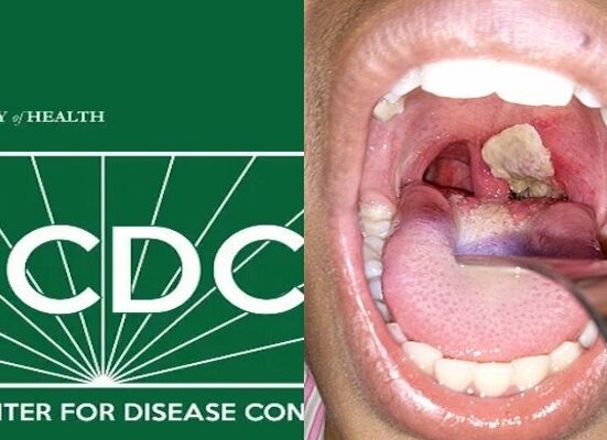 Ogun Government Issues Health Alert Over Rising Diphtheria Cases