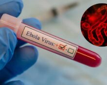 Ebola May Have Spread Beyond DR Congo Borders, WHO Warns