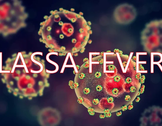 Lassa fever death toll rises to 191 in Nigeria